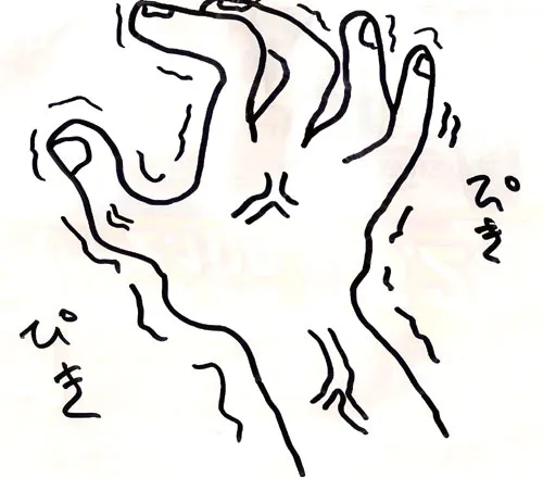 地味な神経痛