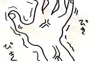 地味な神経痛