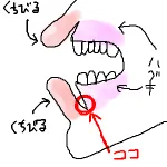 【第1662回】口内炎界のワーストポイント